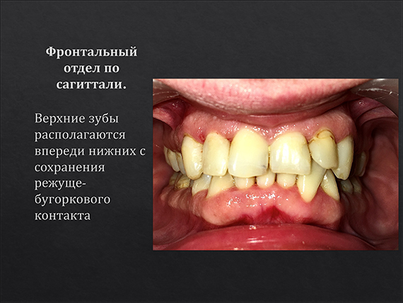 prezent_12