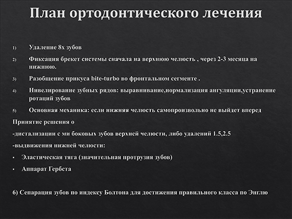 prezent_21