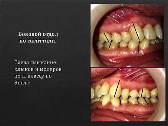 prezent_9